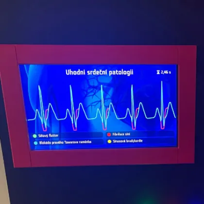 Ostravští vědci vytvořili pro Svět techniky model srdce, ukazuje i jeho poruchy